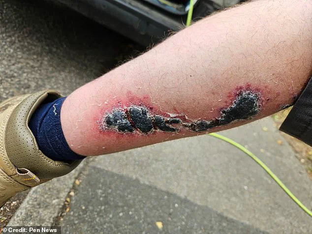 Urgent Alert: Window Cleaner Hospitalized After 'Britain's Most Dangerous Spider' Bite Sparks Renewed Safety Concerns in UK