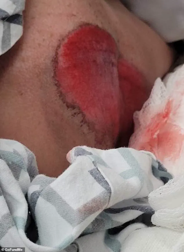 Backpack Saves 12-Year-Old in Kaukauna Traffic Crash