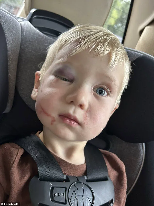 Judge Grants Bail to Daycare Worker Accused of Severe Injuries, Faces Threats