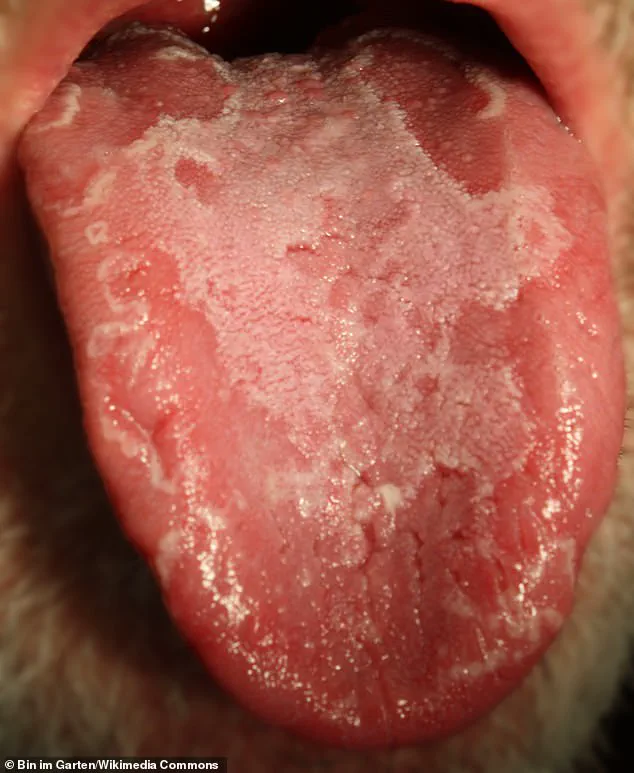 Kate McKinnon Shares Her Experience with Geographic Tongue