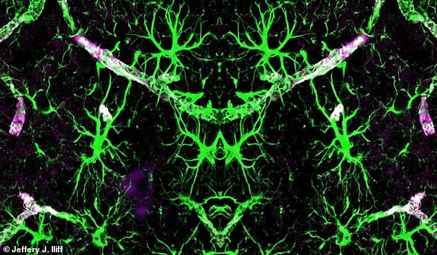 Sleep Positions and Brain Health: Expert Insights on a Hidden Factor in Cognitive Wellness