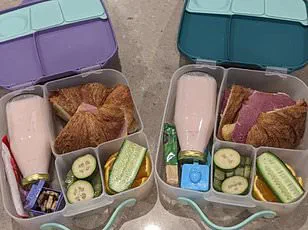 Mother's Decision to Laser Daughter's Birthmark Sparks Debate Over Bullying Fears, Medical Risks, and Community Ethical Dilemmas