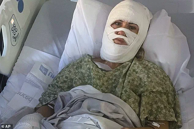 Brutal Acid Attack Leaves Georgia Woman Disfigured, Facing Millions in Medical Bills