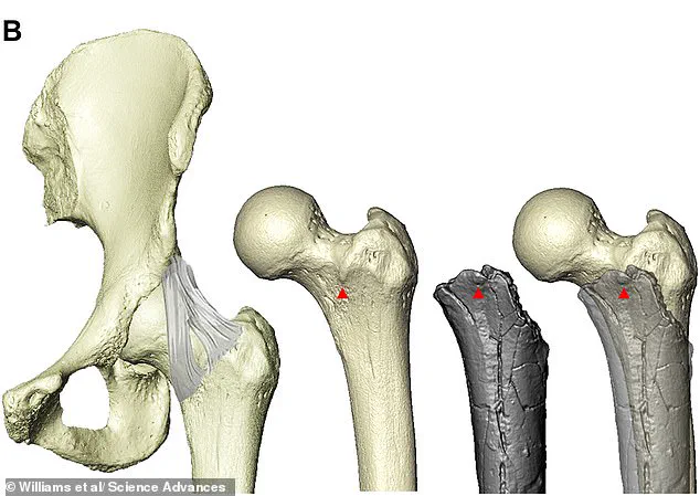 Exclusive Glimpse into Human Evolution: Scientists Pinpoint the Start of Bipedalism in Africa Seven Million Years Ago