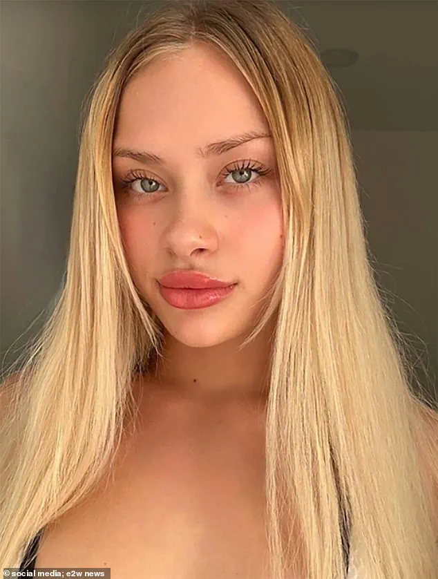 Shrouded in Mystery: The Unrevealed Truth Behind Maria Kovalchuk's Injuries