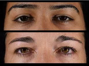 Study Challenges Plant-Based Narrative: Fudan University Research Sparks Global Debate on Meat Consumption and Longevity