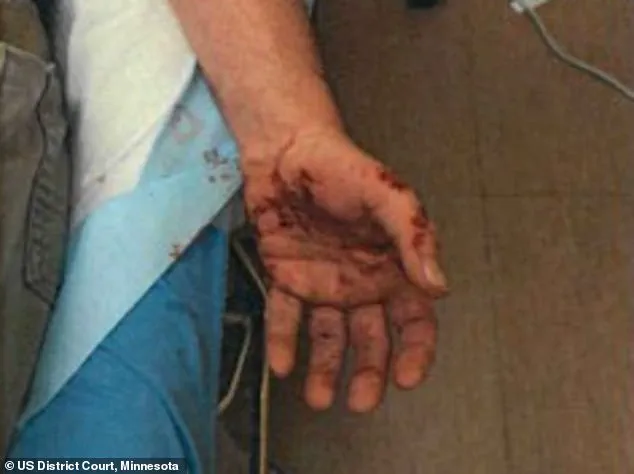 ICE Agent Jonathan Ross's Past Injury Resurfaces Amid Controversy Over Fatal Shooting in Minneapolis