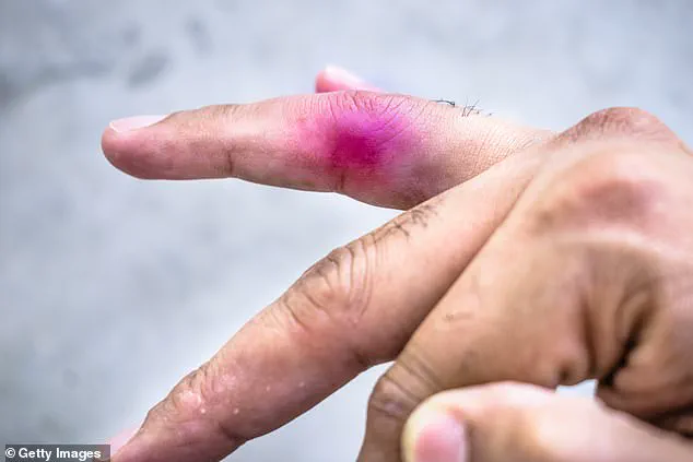 Nine-Year-Old Sues 11-Year-Old After Playground Injury Sparks Legal Debate in Alberta