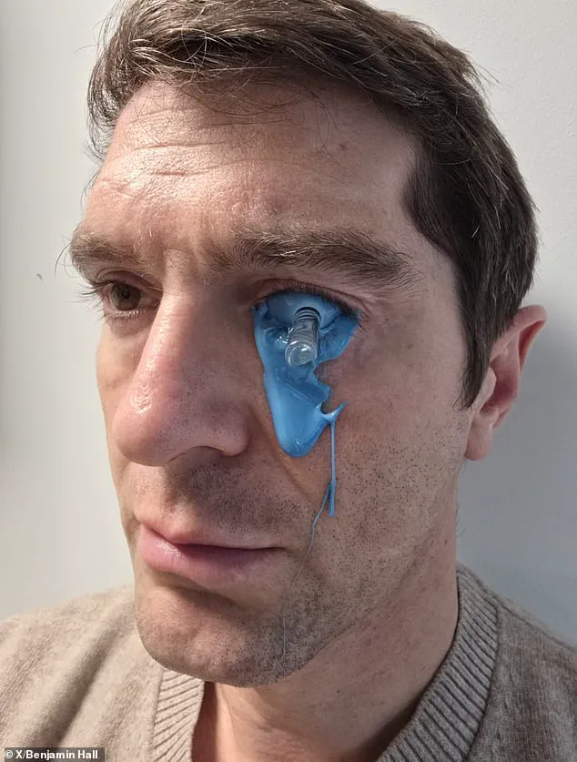 Fox News Correspondent Benjamin Hall Shares Graphic Recovery Journey After Life-Altering Injuries in Ukraine, 2022