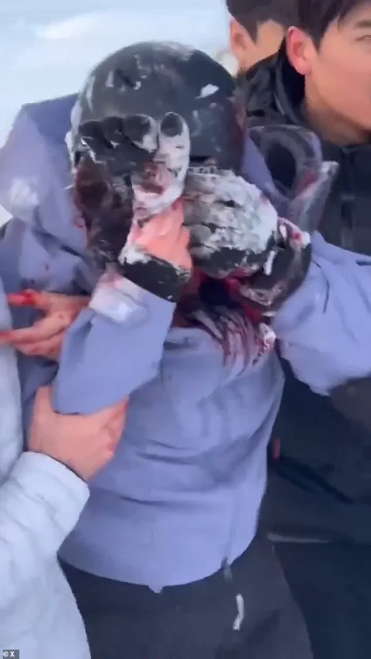 Chilling Selfie with Snow Leopard Leads to Harrowing Attack in Chinese UNESCO Park