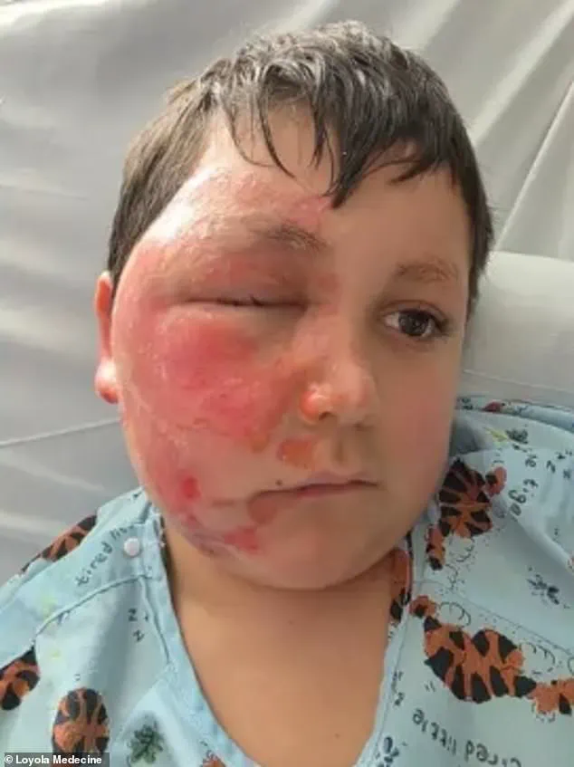 Nine-Year-Old's Severe Burns From Microwaving Sensory Toy in TikTok Trend