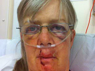 Firefighters Rescue Man Trapped in Tree After Angry Cow Chase on Isle of Wight