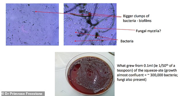 Study Urges Daily Replacement of Kitchen Sponges to Combat Germ Spread