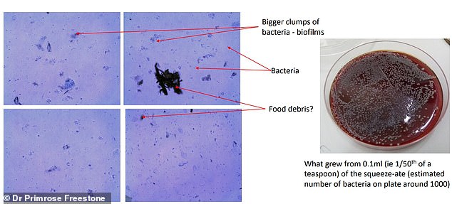 Study Urges Daily Replacement of Kitchen Sponges to Combat Germ Spread