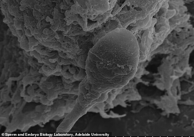 Perilous Journey of Human Sperm in Microgravity Challenges Space Colonization Dreams