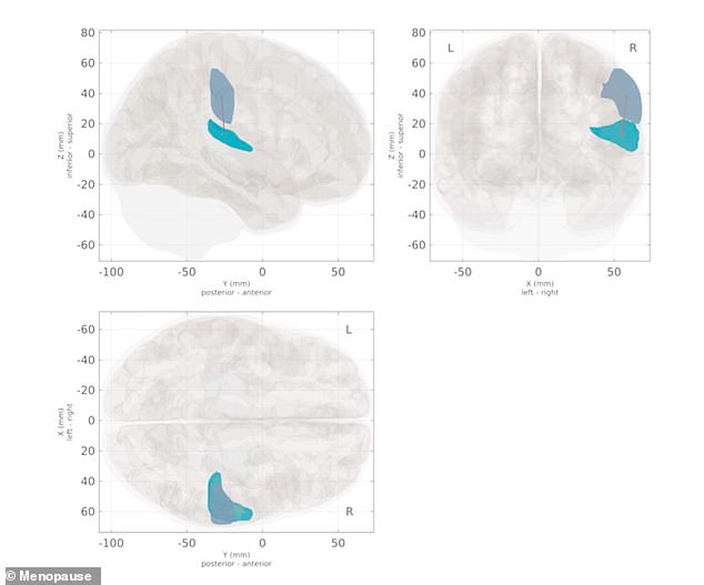 Estrogen Drop During Menopause Drives Higher Dementia Risk in Women