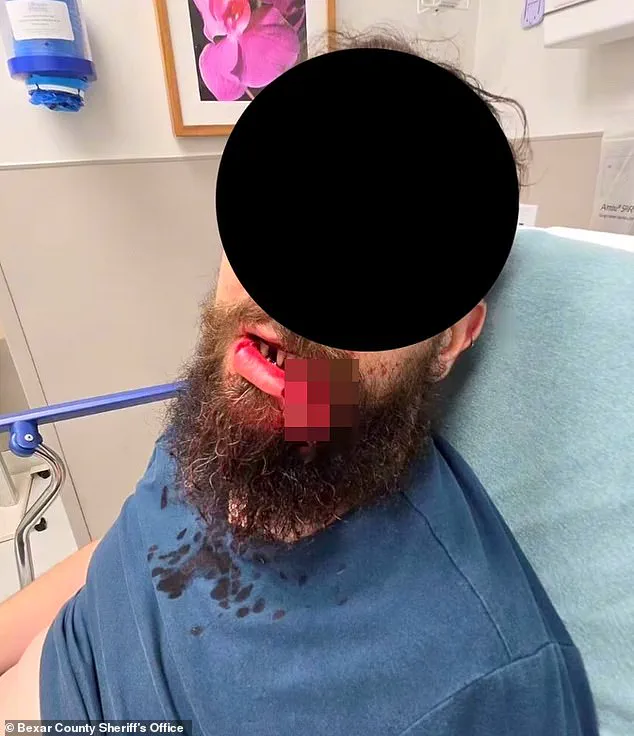 Texas Woman's Pit Bull Mauls Man's Face; Owner Denies Wrongdoing