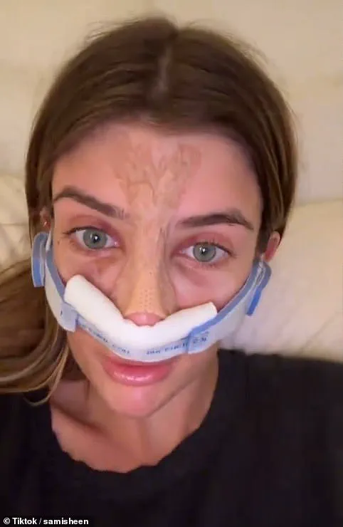 Sami Sheen's Hidden Struggles: From Bullying to OnlyFans at 18 for Plastic Surgery Fund