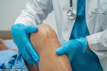 Former NYPD Officer Jennifer, 68, Faces Osteoarthritis After 27 Years of Service