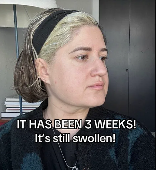 'It was a total 'shower-thought' moment...': Seattle bride sparks online debate by using ChatGPT to recommend cosmetic procedures ahead of her wedding