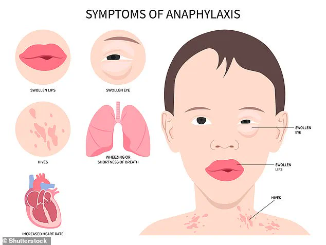 Rapid Expansion of Venomous Asian Needle Ant Sparks Alarms Across 19 US States