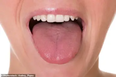 Urgent Health Alert: Tongue Changes Signal Serious Conditions, Experts Advise Immediate Attention