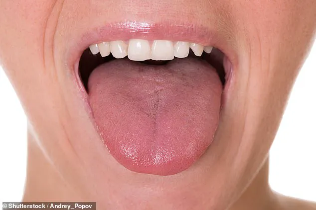 Urgent Health Alert: Tongue Changes Signal Serious Conditions, Experts Advise Immediate Attention