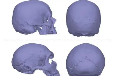 Breaking: New Study Links Neanderthal Genes to Chronic Headaches, Raising Evolutionary Questions