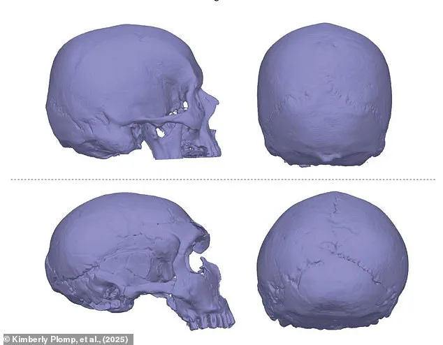 Breaking: New Study Links Neanderthal Genes to Chronic Headaches, Raising Evolutionary Questions
