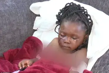 Exclusive: Five-Year-Old Girl Survives Brutal Pit Bull Attack in South Bend