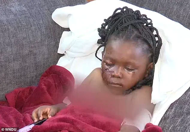 Exclusive: Five-Year-Old Girl Survives Brutal Pit Bull Attack in South Bend