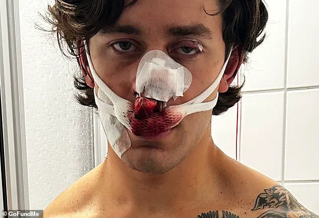 Heroic Intervention Turns Viral as Young Model Seeks Support After Severe Injuries in Germany Attack
